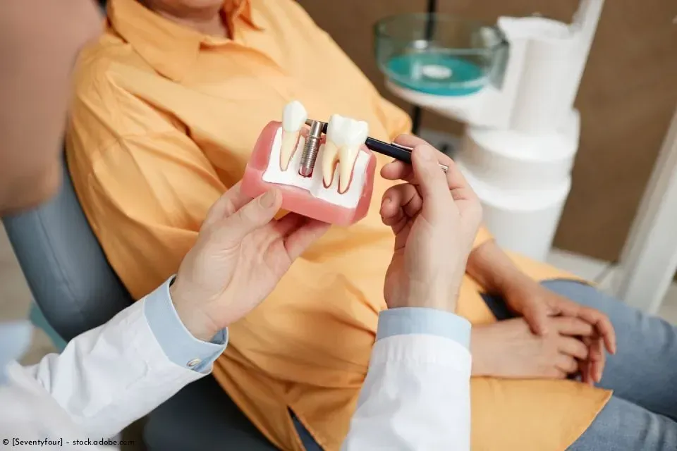 Zahnarzt zeigt einem Patienten im Rahmen einer Sprechstunde Modelle von Zahnimplantaten.