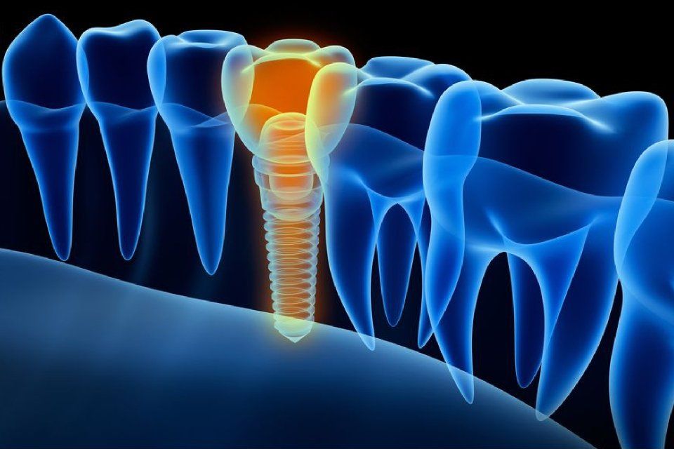 Ein digitales Bild von Zähnen