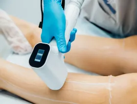 Un profesional con guantes azules utiliza un dispositivo de depilación láser en la pierna de una persona, que está cubierta con gel de tratamiento.