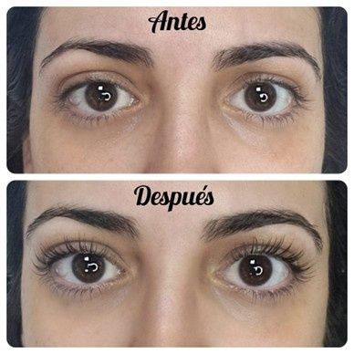 Un profesional con guantes azules utiliza un dispositivo de depilación láser en la pierna de una persona, que está cubierta con gel de tratamiento.