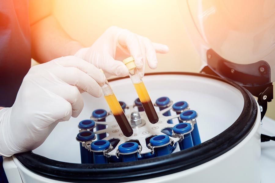 Autologes plättchenreiches Plasma