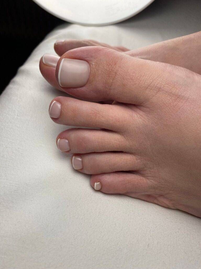 Eine Nahaufnahme der Zehennägel einer Person auf einer weissen Oberfläche. Foto von Fusspflege Pohl