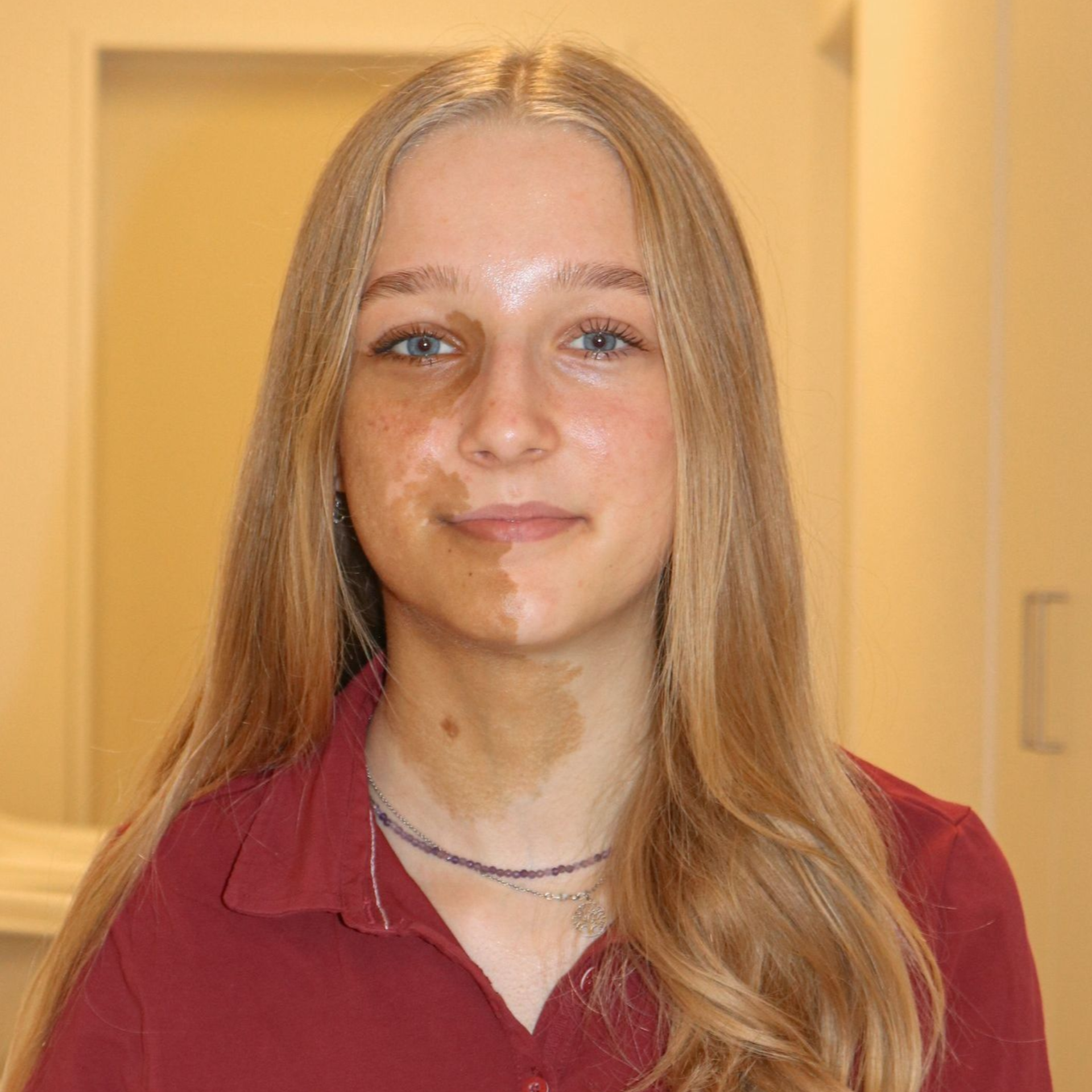 Erlosenpraxis Hildisrieden