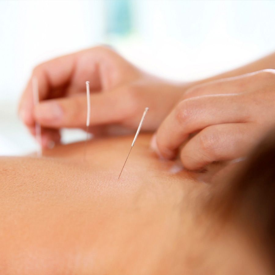 Acupuntura clínico