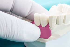 Una persona con guantes blancos sostiene un modelo de dientes.