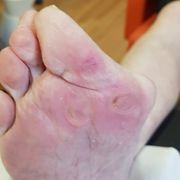 APRÈS - Cors Mme B.