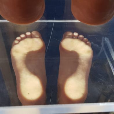 Empreinte de pieds sur podoscope