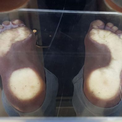 Empreinte de pieds sur podoscope