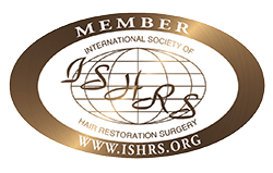 Siegel Member Hair Restoration Surgery