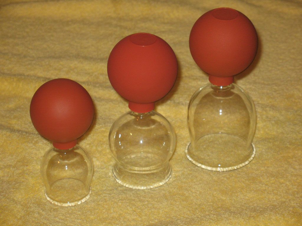 Schröpfen - Naturheilpraxis Katharina Studer - Langendorf