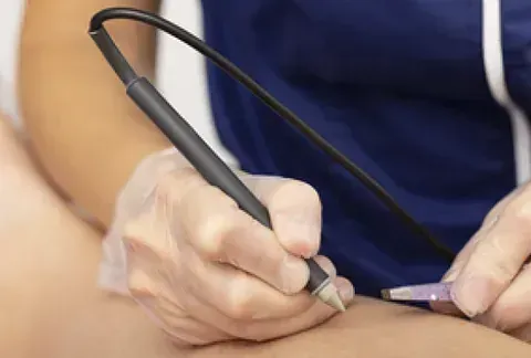 Una persona está usando un bolígrafo para escribir en el brazo de otra persona.