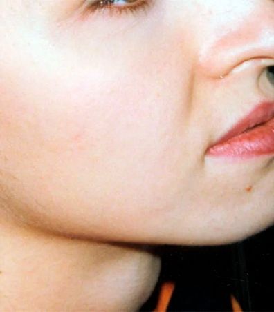 Primer plano del rostro de una persona. Se ven la nariz, la boca y las mejillas. Labios y piel rosados.