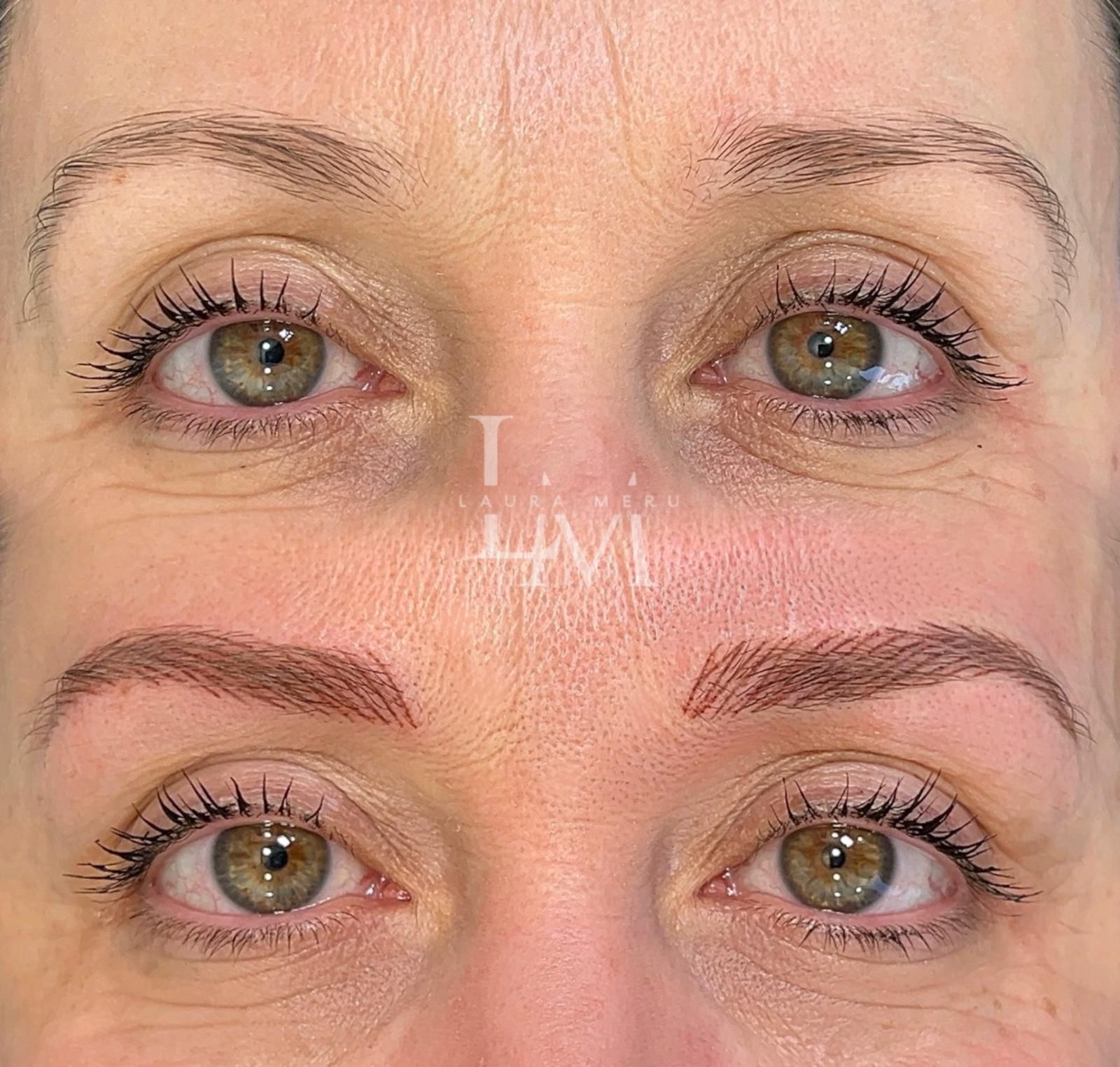 Comparación de las cejas antes y después, mostrando los resultados de un procedimiento de tatuaje cosmético o microblading.