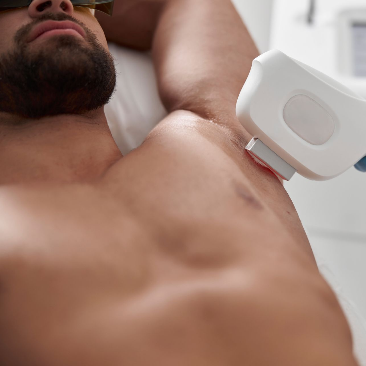 Un homme se fait épiler les aisselles au laser.