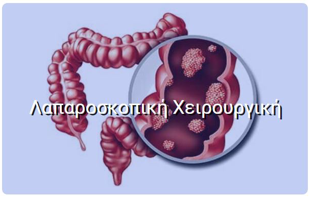 Λαπαροσκοπική Χειρουργική