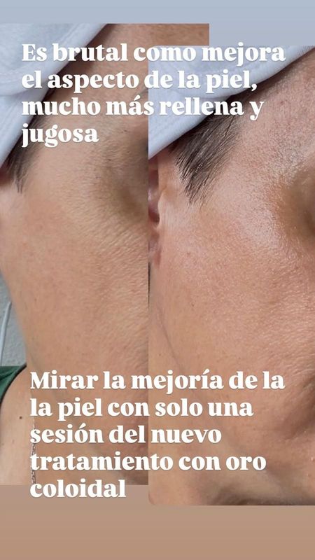 Primer plano de la textura