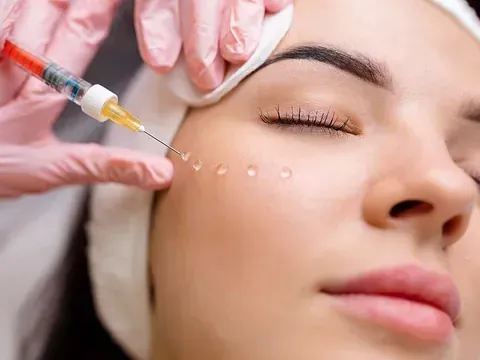 Una mujer recibe una inyección de botox en la cara.