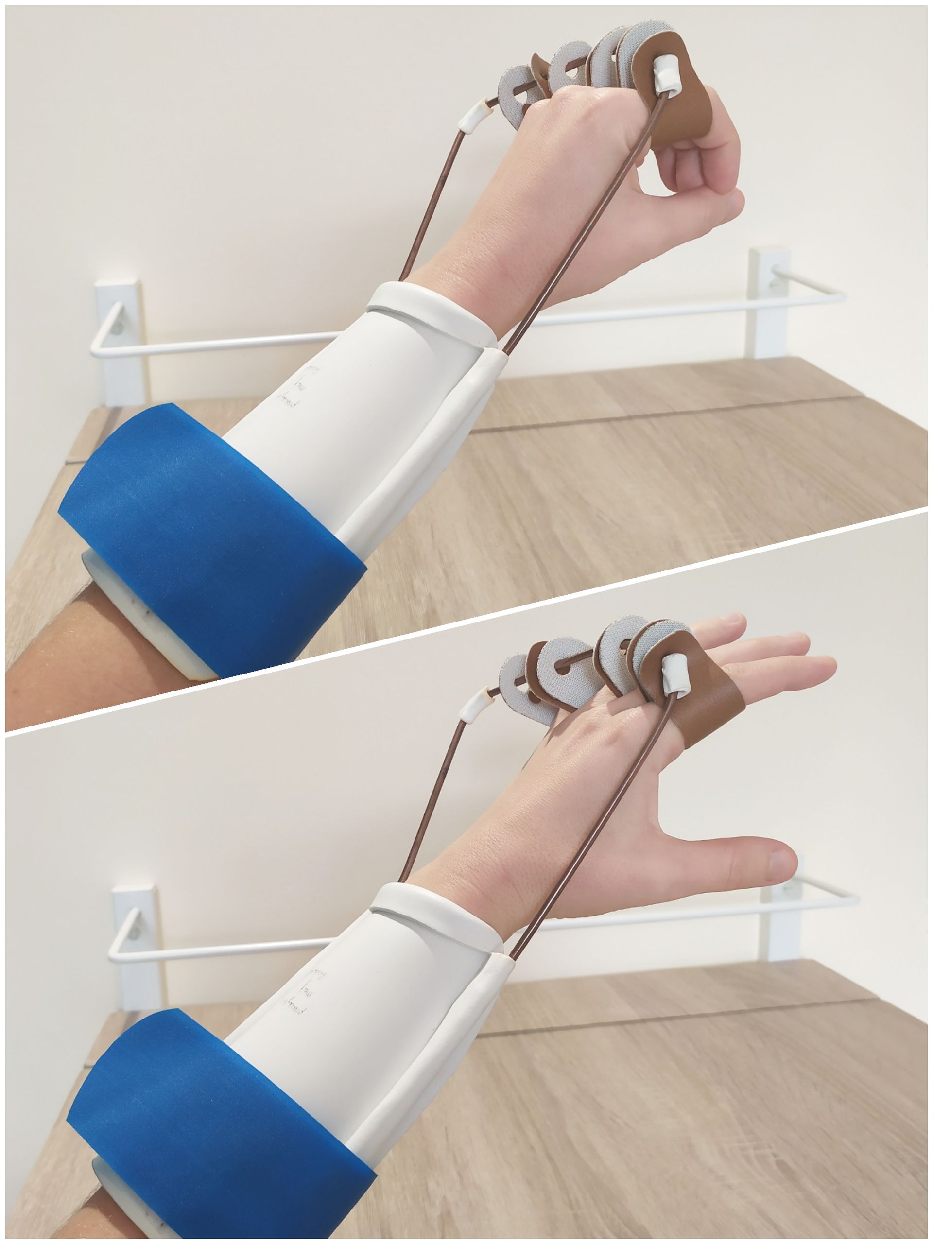 Orthèse thermoformée