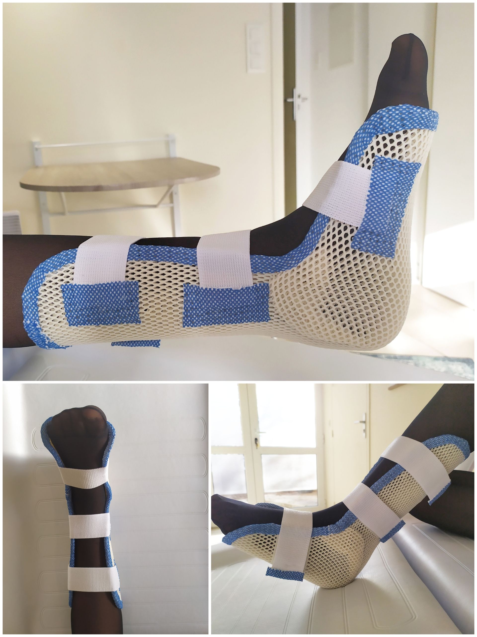 Orthèse thermoformée pour le pied et la cheville