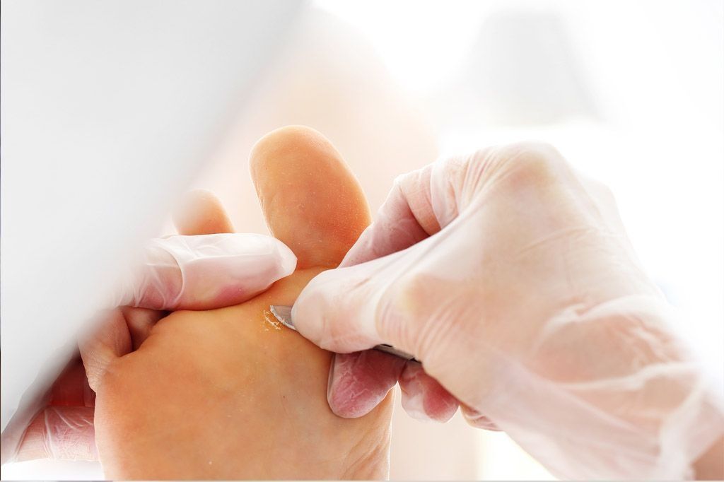 Un primer plano del pie de una persona siendo examinado por un médico.