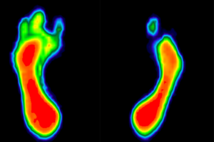cabinet-de-podologie-centre-de-soins-du-croset-ecublens