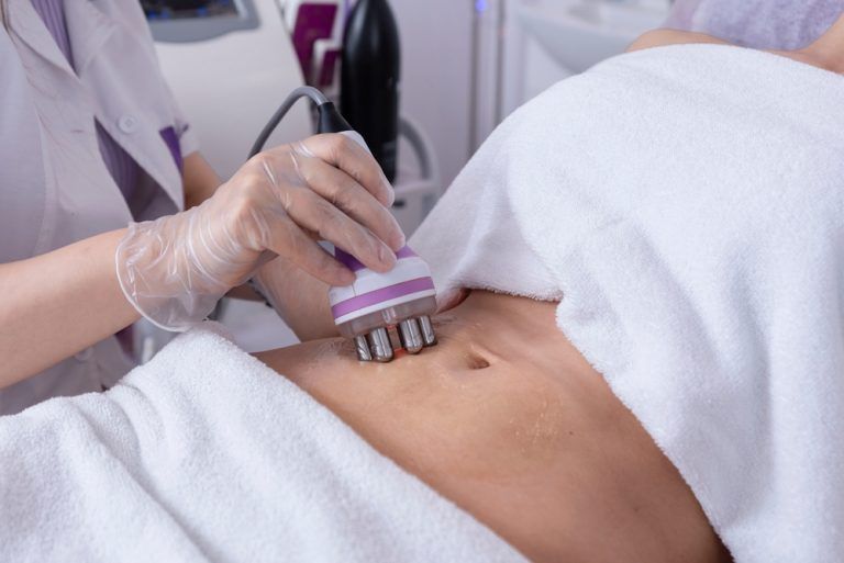 Une personne subissant un traitement par radiofréquence de l'abdomen