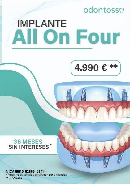 Un cartel para implante all on four con un precio de 4.990 euros