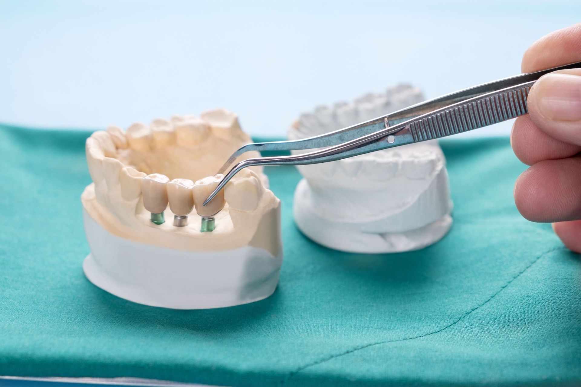 Una persona sostiene un par de pinzas sobre un modelo de dientes.
