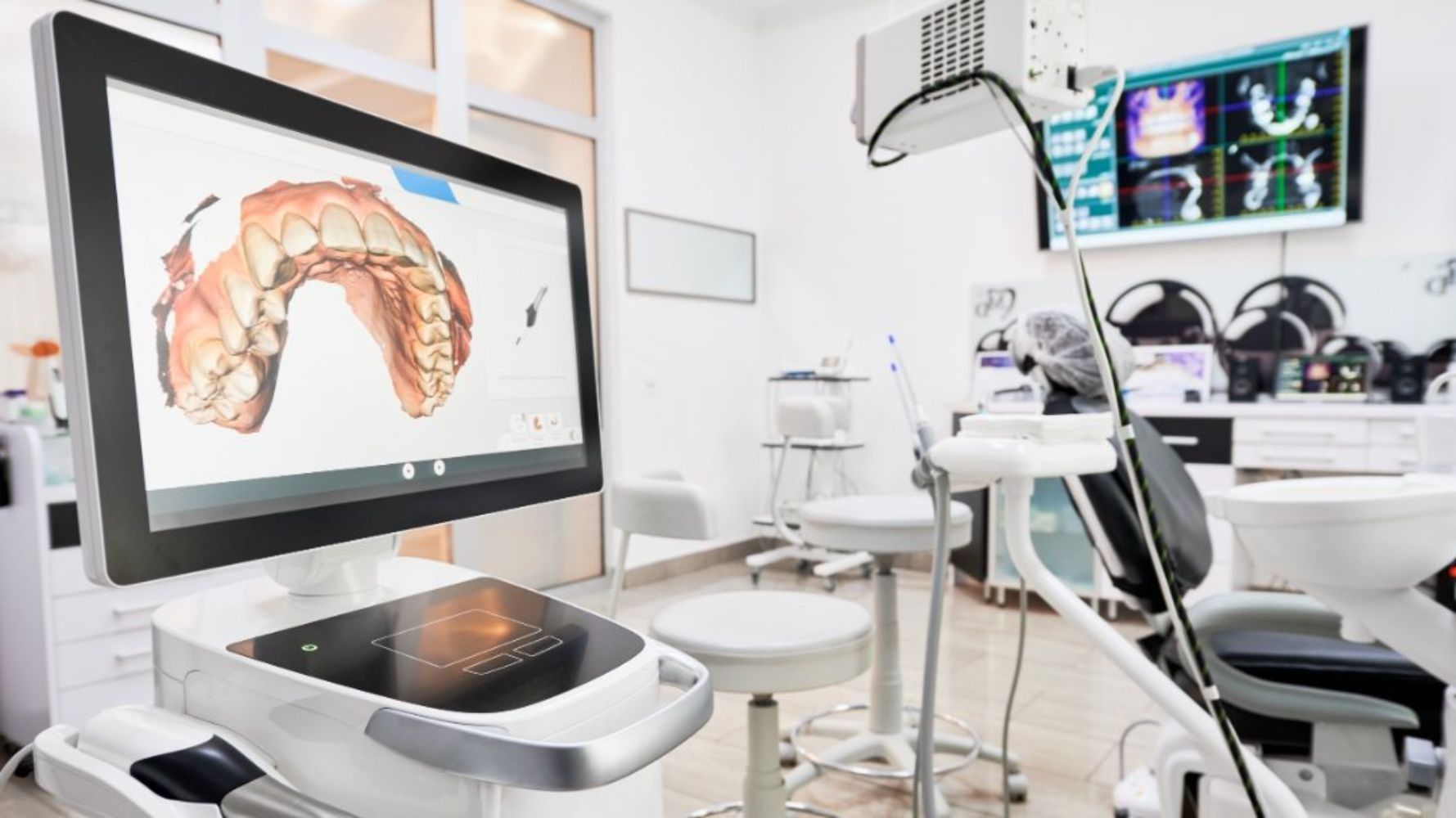 Un consultorio dental con una computadora y un sillón dental.