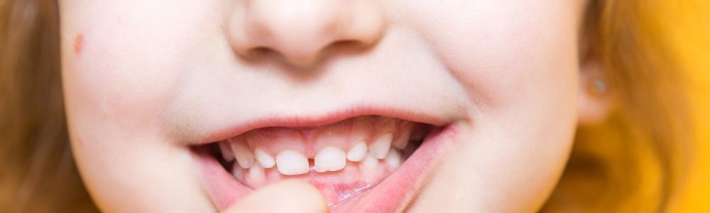 Un primer plano de la boca de un niño con un dedo dentro.