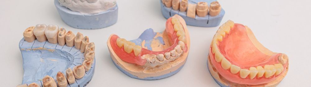 Un grupo de dentaduras postizas están colocadas una encima de otra sobre una mesa.