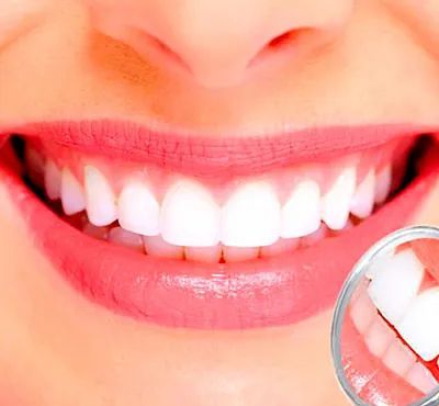 Primer plano de una boca sonriente con dientes blancos y brillantes y labios rosados. Detalle ampliado del cepillado.