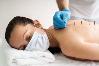 Mujer recibe acupuntura en la espalda mientras usa una máscara; una persona con guantes azules inserta agujas.