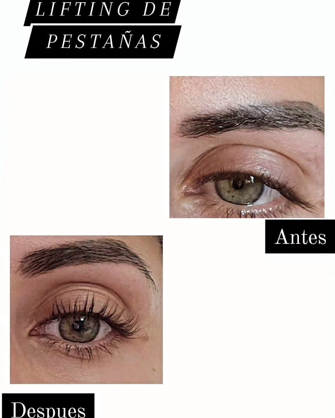Antes y después del lifting de cejas: primeros planos de los ojos etiquetados como 