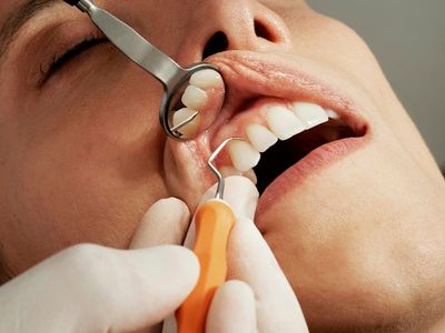 Un dentista utiliza un espejo dental y un instrumento para examinar de cerca los dientes de un paciente.