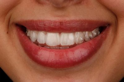 Primer plano de una boca sonriente con lápiz labial rojo y dientes blancos.
