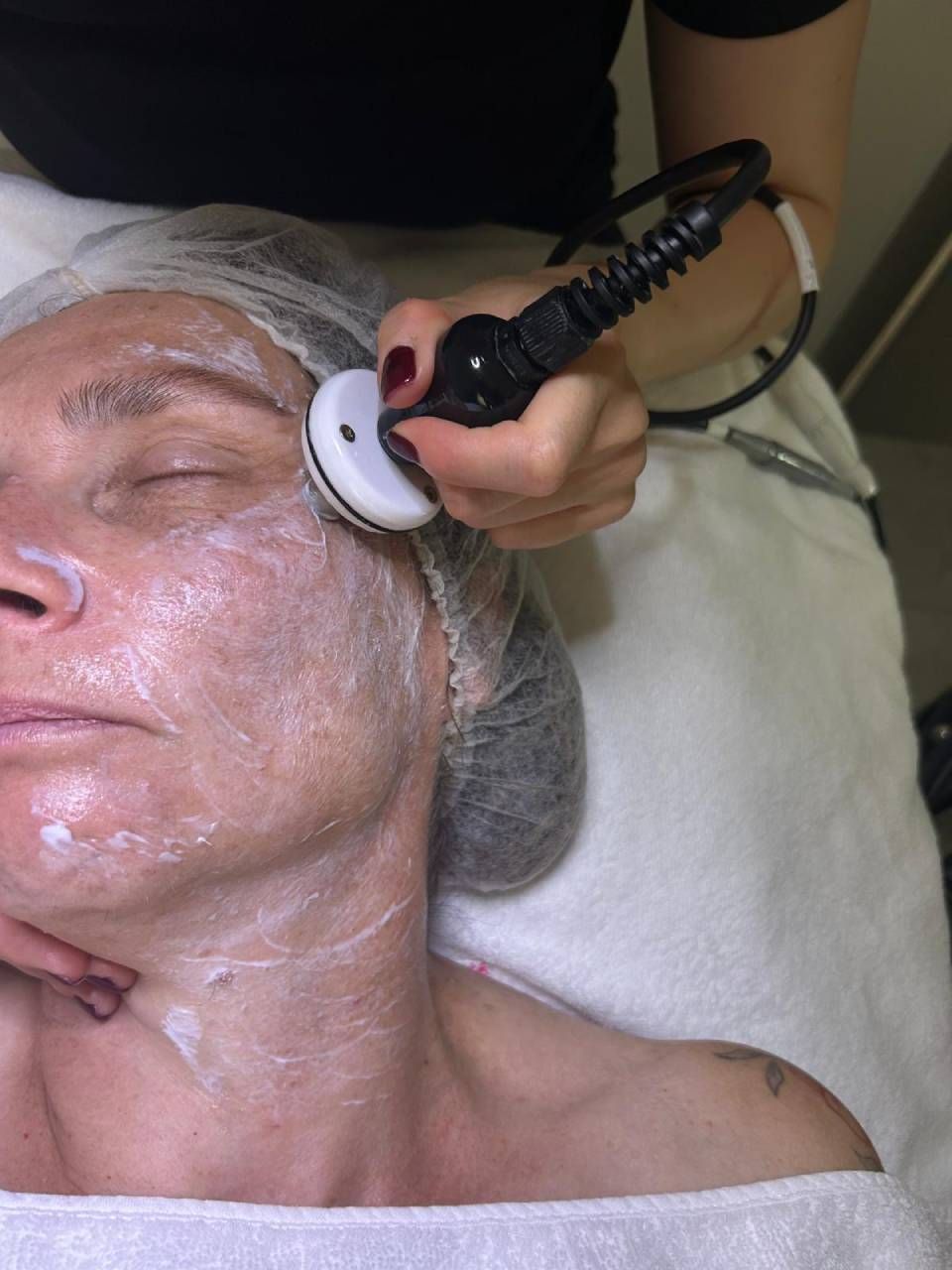 Une personne reçoit un soin du visage à l'aide d'un appareil portatif. Une crème est appliquée sur le visage.