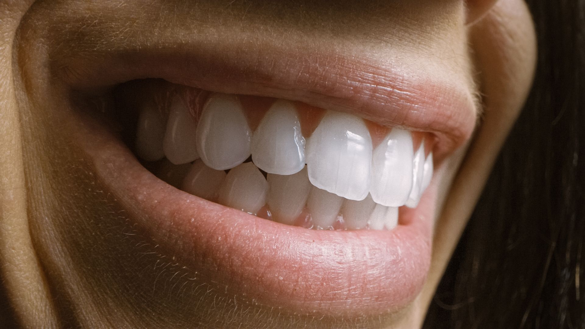 Primer plano de una persona sonriendo, mostrando dientes blancos brillantes y encías rosadas.