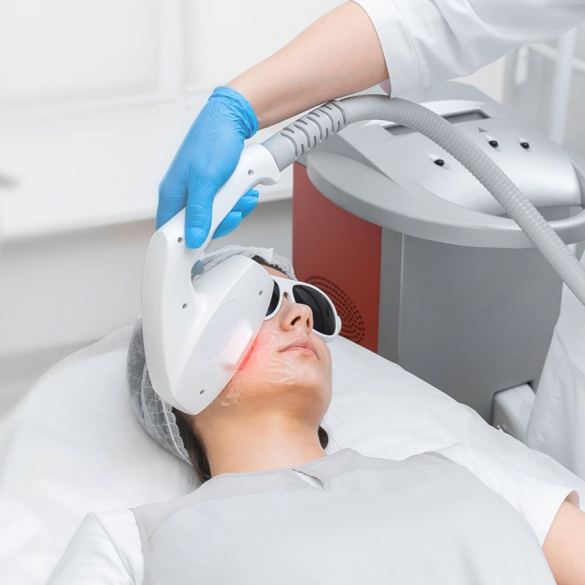 Une personne reçoit un traitement laser du visage.