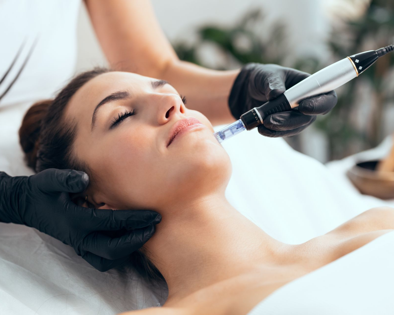 Une femme reçoit un traitement de microneedling au visage.