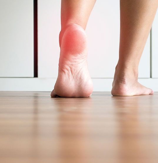 Primer plano de pies descalzos sobre un suelo de madera; un talón muestra enrojecimiento o irritación.