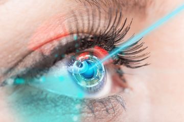 Un primer plano del ojo de una mujer siendo tratado con un láser.