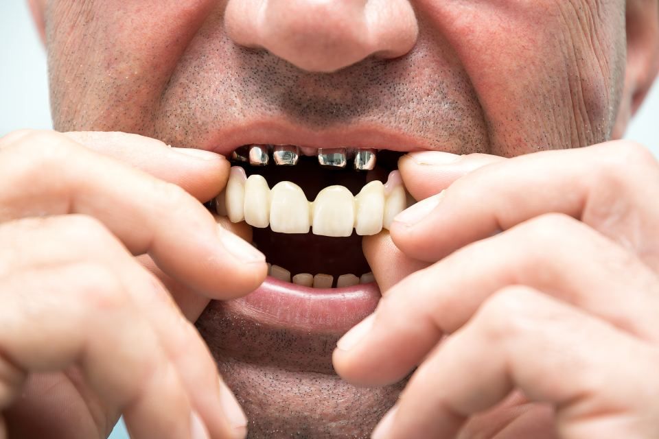 Eine Nahaufnahme vom Mund eines Mannes mit Zahnspange