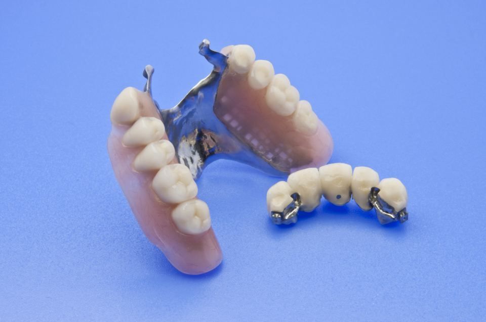 Eine Nahaufnahme einer Zahnprothese auf einer blauen Oberfläche