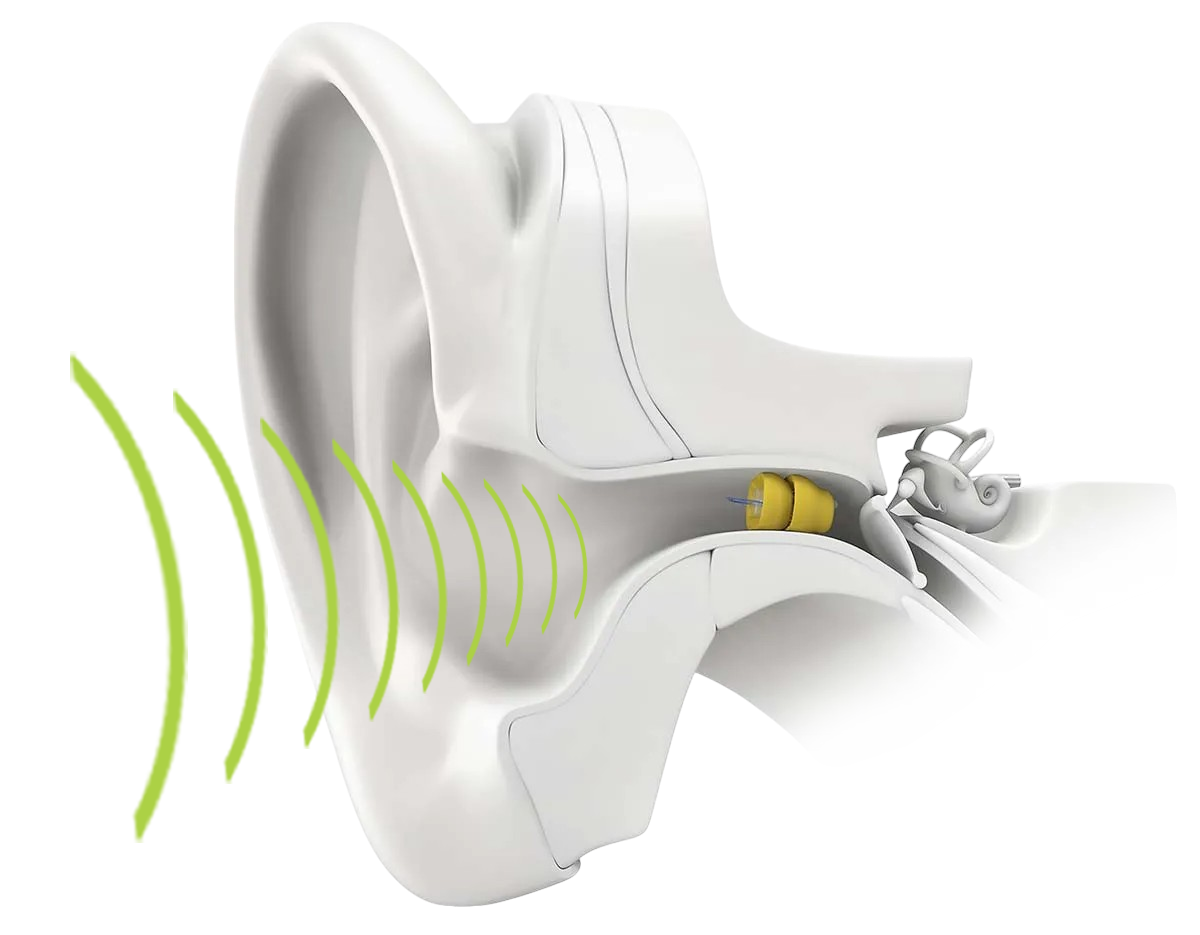 Illustration oreille interne avec docteur