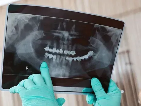 Un dentista sostiene una radiografía de los dientes de una persona.