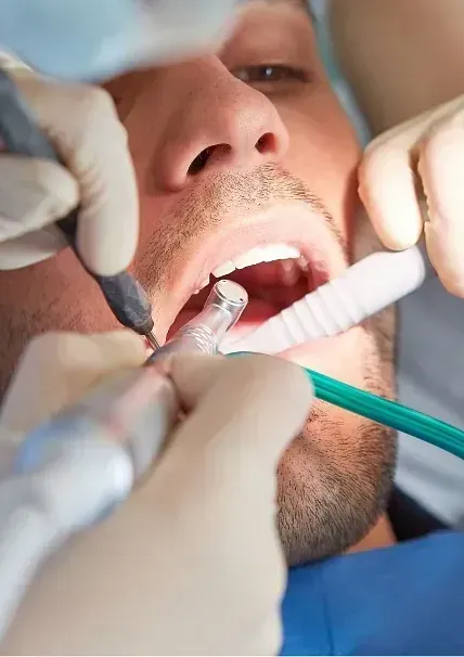 Un hombre se está haciendo examinar los dientes por un dentista.