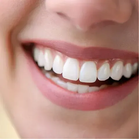 Un primer plano de la sonrisa de una mujer con dientes blancos y labios rosados.