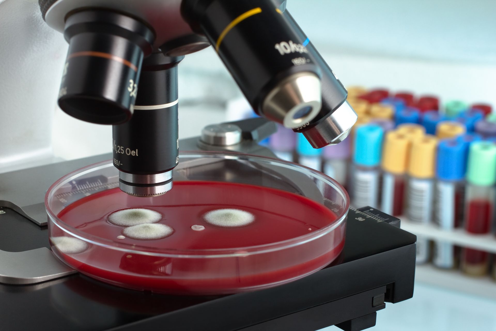 Analyse d'un champignon au microscope.