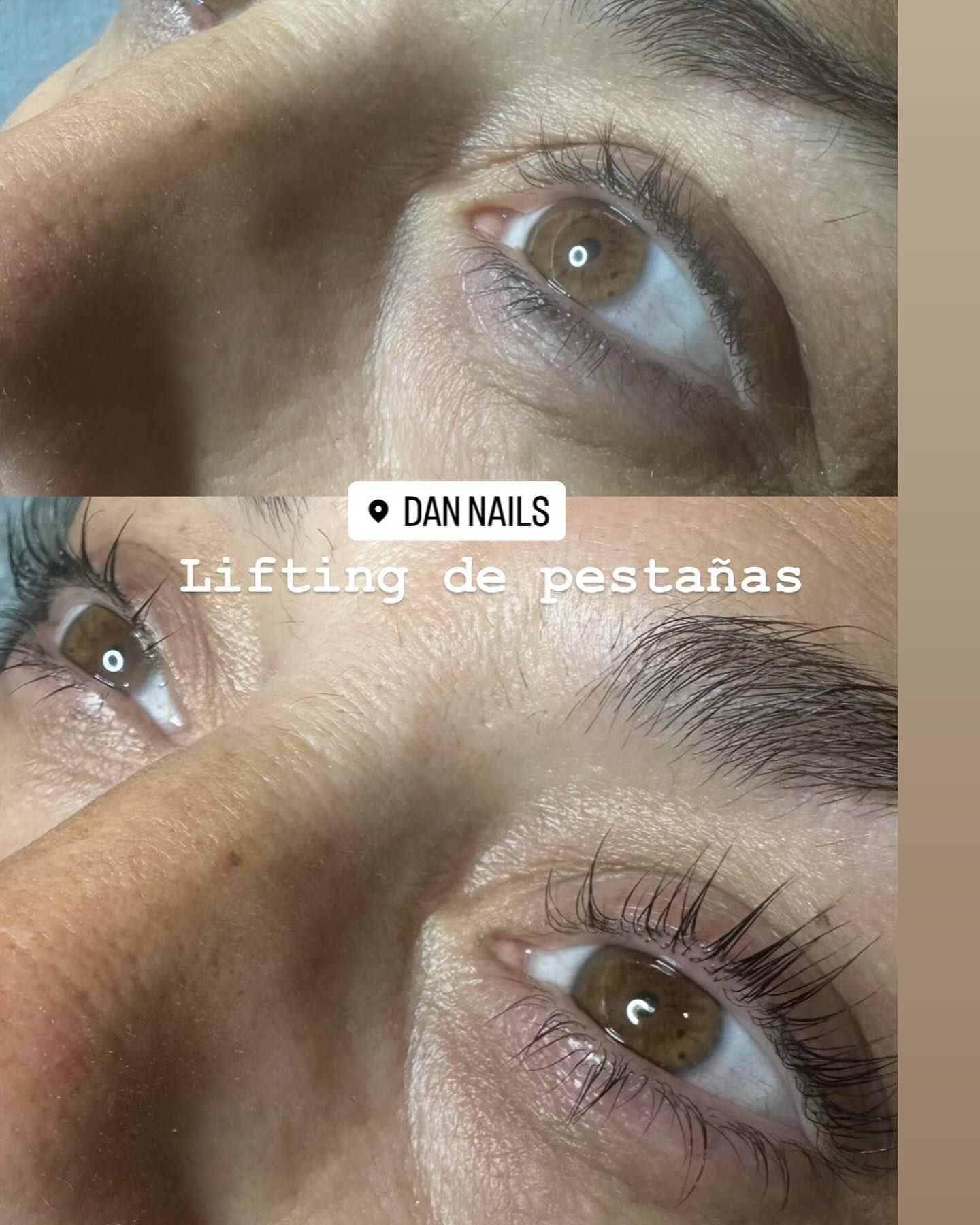 Una foto de antes y después de las pestañas de una mujer.